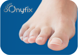 Onyfix Ingrown Toenail Treatment